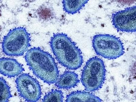 Virus causador da variola dos macacos, imagem vista desde um microscopio. A varíola dos Macacos foi recentemente classificada como emergência global.